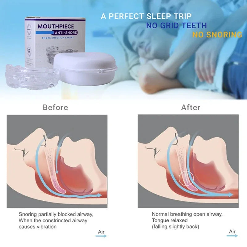 New Mouth Guard Anti-Snoring Teeth Bruxism Mouthguard Improves Sleep Teeth Bruxism Sleep and Apnea Snoring Device Stops Snoring