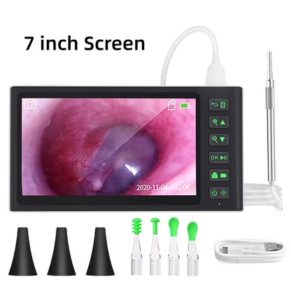 Digital Otoscope with Screen 3.9mm 1080P HD Ear Scope Endoscope Ear Cleaner With 2500mAh Rechargeable Battery