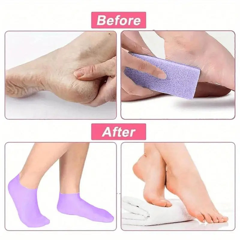1 Pair of Silicone Socks, Suitable for Dry and Cracked Feet | Women's Foot Moisturizing Socks for Dry and Cracked Heels, Powerful Moisturizing Foot Care, Moisturizing Foot Mask