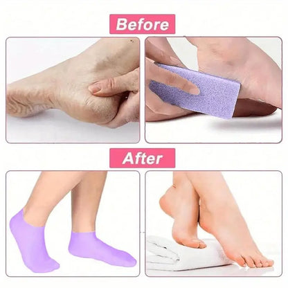 1 Pair of Silicone Socks, Suitable for Dry and Cracked Feet | Women's Foot Moisturizing Socks for Dry and Cracked Heels, Powerful Moisturizing Foot Care, Moisturizing Foot Mask