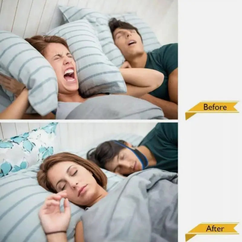 2 PCS Anti Snore Chin Strap Stop Snoring Belt Sleep Apnea Support Solution NEW