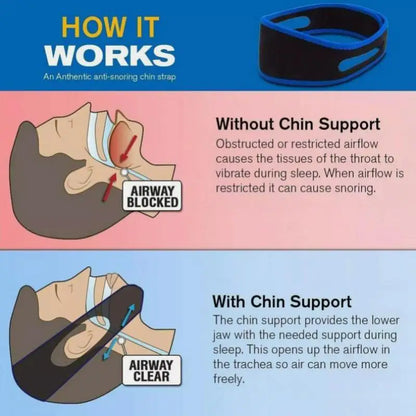 2 PCS Anti Snore Chin Strap Stop Snoring Belt Sleep Apnea Support Solution NEW