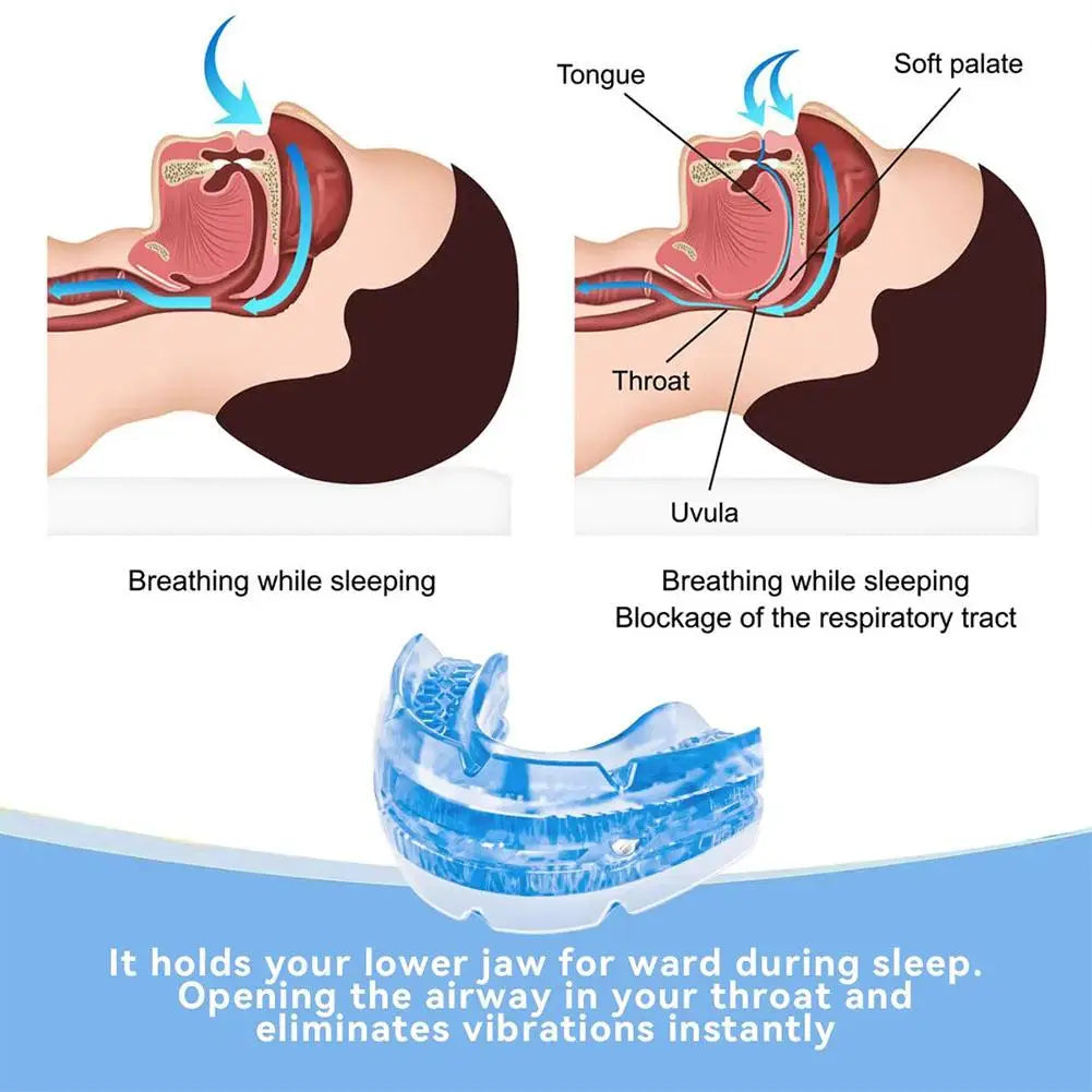 Anti-Snoring Device Anti Snoring Mouthpiece Mouth Guard for Women Men Snore Reducing Most Comfortable Adjustable Oral Appliance