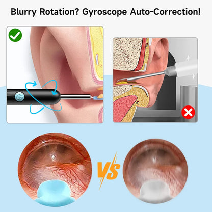 WiFi Visual Ear scope Camera 1080P for iPhone/Android Ear Picker Cleaning Wireless Endoscope Otoscope with Ear Wax Removal Tools