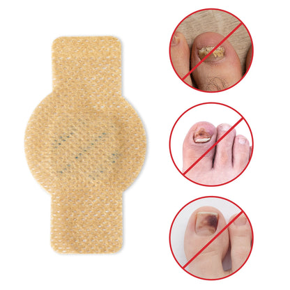 Toenail Fungus Treatment Extra Strength Patches Night-Time Treatment Improves Nail Appearance for Damaged Nails Foot Nails